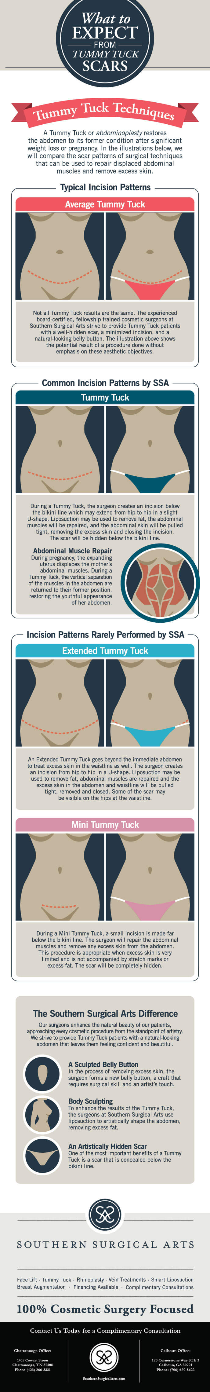 Tummy Tuck Scars: Treatment, Timelines, and Scar Revision - Chau Plastic  Surgery